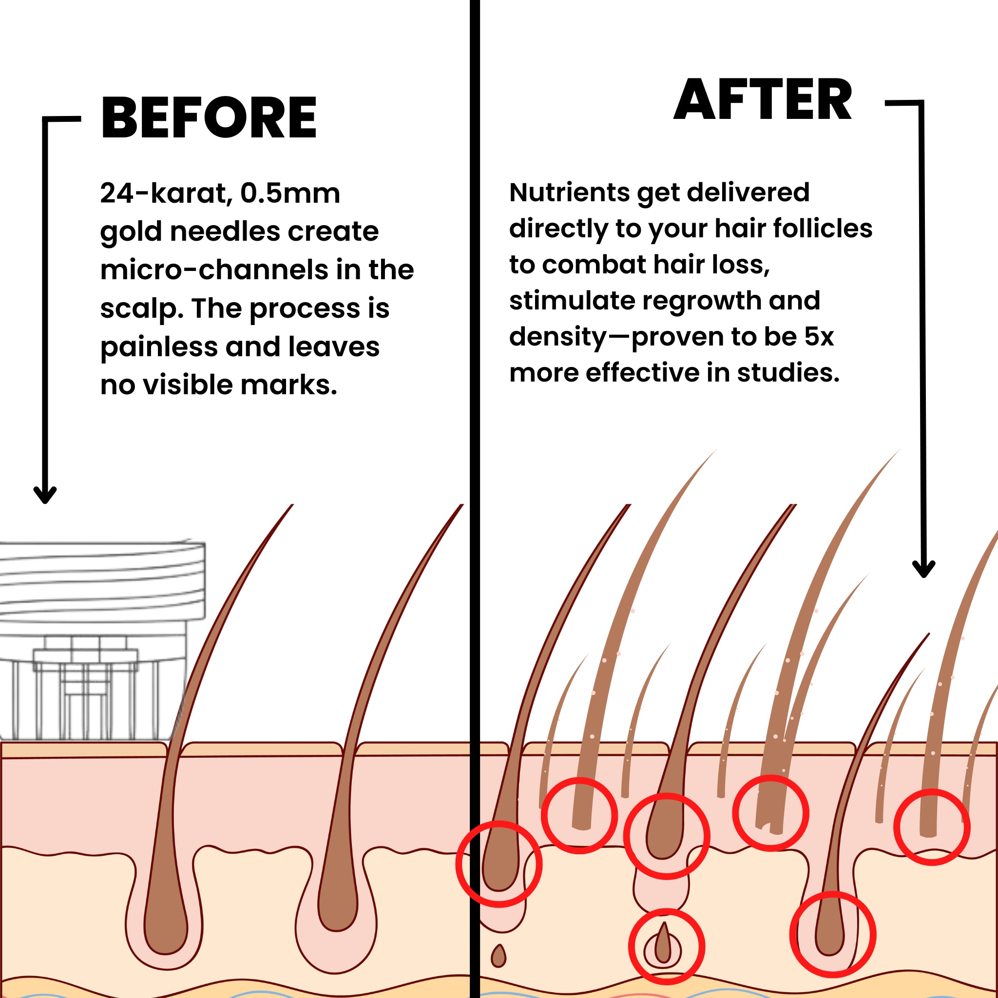 AlphaVance™ Hair Regrowth System